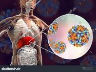 Sănătate Publică: Ieșenii se pot testa gratuit pentru Hepatitele B și C la medicul de familie, indiferent de statutul de asigurat